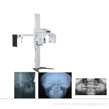 Panoramic Dental X-ray